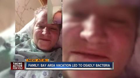 Woman dies two months after getting flesh-eating bacteria while vacationing in St. Pete, Florida