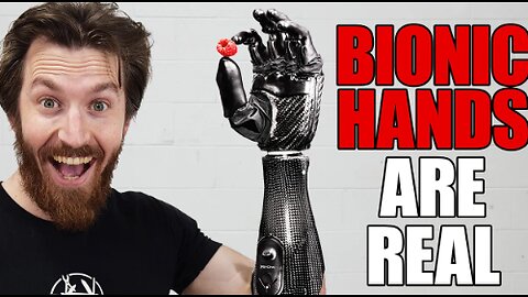 This Bionic Hand Will Change Everything!