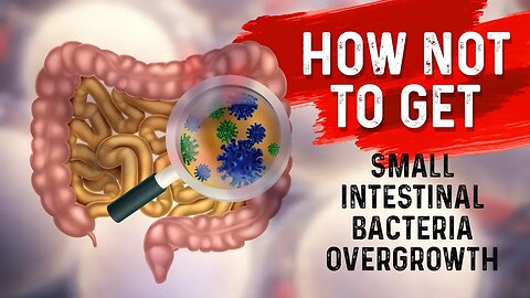 How to STOP Small Intestine Bacterial Overgrowth(SIBO)? – Dr. Berg