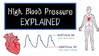 What is High Blood Pressure?