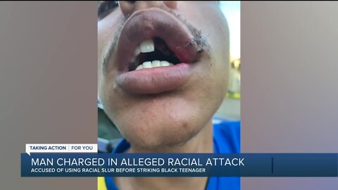 Man charged in alleged racial attack