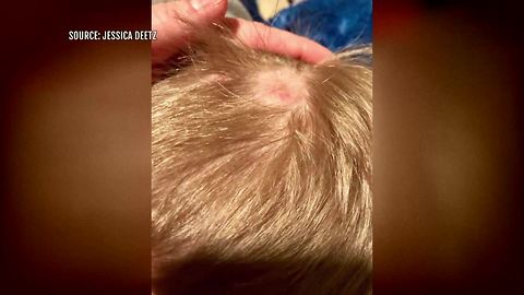 Complaints, class action lawsuits pile up against hair care company Monat