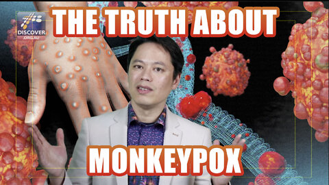 The Truth About Monkey pox