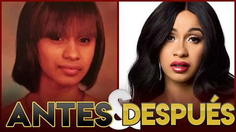 CARDI B - Transformación Antes y Después - CIRUGÍAS PLÁSTICAS