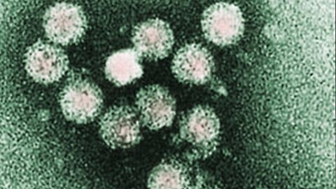 St. Lucie County offering free hepatitis A vaccines as new cases surface