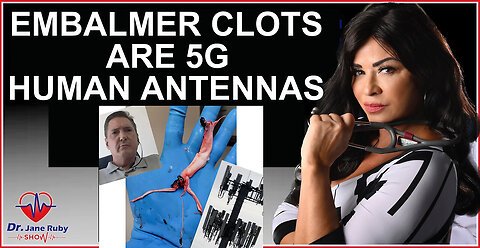 BOMBSHELL: PROOF EMBALMER CLOTS ARE 5G CONTROLLED HUMAN ANTENNAS