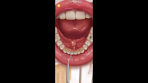 Satisfying Teeth Cleaning Asmr animation.