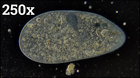 Large Ciliate Swimming under the Microscope