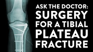 Ask the Doctor: Surgery for a tibial plateau fracture