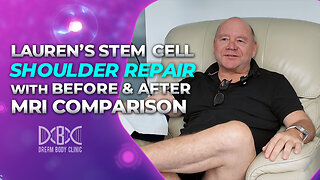 Lauren's Stem Cell Shoulder Repair with Before & After MRI Comparison