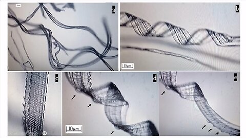 Recent🤔Study📝Shows👀Self-Assembly👉Nanobots🤖In👀The👉COVID-19💉Injectables💉💥🔥🤬😡🤬