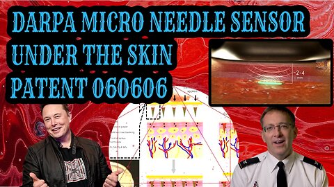 DARPA TECHNOLOGY THAT “MONITORS” YOUR HEALTH STATUS - MICRO-NEEDLE PATCH - LUMEE - PATENT 060606