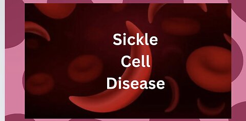 Sickle Cell Disease Kt: All Natural