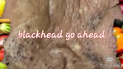 Blackhead removal satisfying video #3