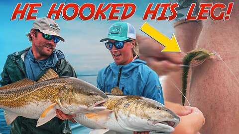 Fishing MONSTER Red Drum & Hook Stuck in Leg!!