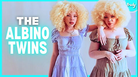 Identical Twins With Albinism Are 1 In 2 Million | BORN DIFFERENT