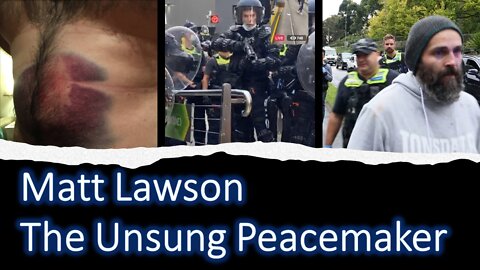 Matt Lawson – The Unsung Peacemaker