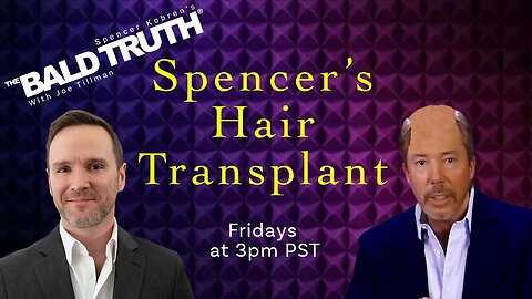 Spencer Kobren's Hair Transplant-The Bald Truth-Episode 2290