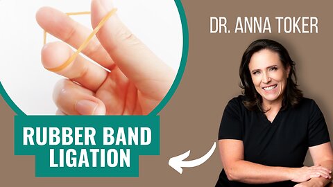 Rubber Band Ligation