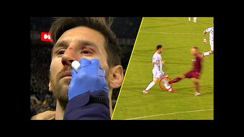 Horror Tackles on Lionel Messi