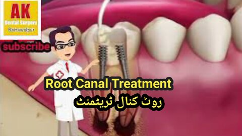 Root canal treatment