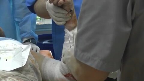 Russian doctors treat wounded Ukrainian POWs in hospitals on LPR territory