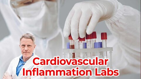 CV Inflammation Labs