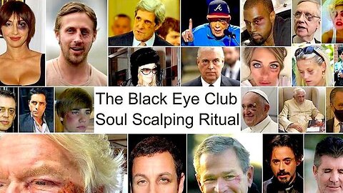 The Black Eye Club