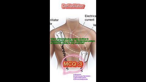 Defibrillator machine in icu #defibrillator #mcqs #pharmacologynotes #MedicalQuiz #mcqs #quiz