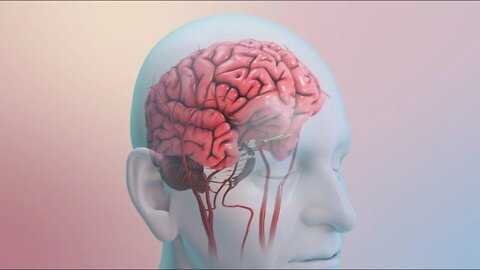 Su riesgo de sufrir un accidente cerebrovascular