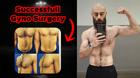 My Entire Gynecomastia Surgery Experience Plus Dos & Don'ts