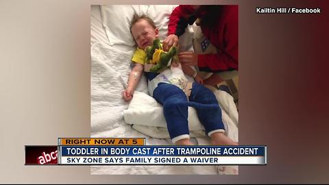 3YO in body cast after trampoline accident