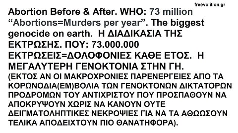 Abortion Before & After. WHO: 73 million AbortionsMurders per year. The biggest genocide on earth ΒΙΝΤΕΟΣΚΟΠΗΣΗ ΕΚΤΡΩΣΗΣ. ΠΟΥ: 73.000.000 ΕΚΤΡΩΣΕΙΣ ANA ΕΤΟΣ. Η ΜΕΓΑΛΥΤΕΡΗ ΓΕΝΟΚΤΟΝΙΑ ΣΤΗ ΓΗ