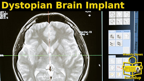 Dystopian Brain Implant