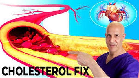 The Most Effective Way to Lower Your Cholesterol Naturally in 7 Days! Dr. Mandell