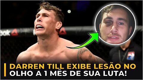 DARREN TILL SOFRE LESÃO NO OLHO A 1 MÊS DE SUA LUTA!