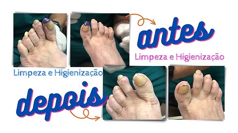 Não subestime o poder de pés saudáveis. Eles te levam para onde você quer ir! #nails #podiatrist