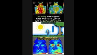 Grounding and Blood Health: How Earth’s Electrons Improve Circulation and Cardiovascular Function