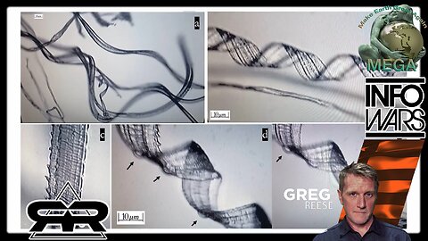 Recent Study Shows Self-Assembly Nanobots in the COVID-19 Injectables · Sep 11, 2024 Greg Reese · Research from Korea and Japan confirm previous reports of nanotech in the COVID-19 injectables | With direct link to video about NICOTINE Solution BELOW