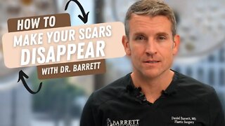 How To Make Your Scars Disappear! | Barrett Plastic Surgery