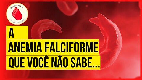 A ANEMIA FALCIFORME e suas COMPLICAÇÕES! Saiba mais! | Geydson Cruz; MD,MSc