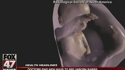 Doctors find new ways to see unborn babies