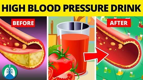 Top 10 Drinks to Lower High Blood Pressure NATURALLY