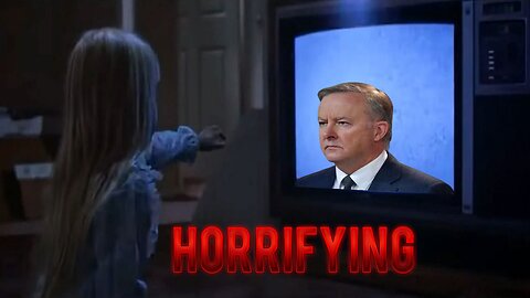 This will scare you about Anthony Albanese