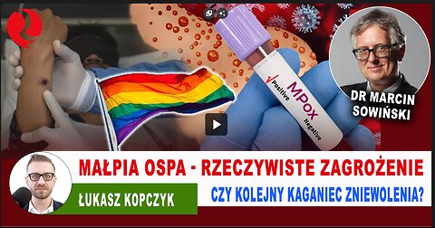 Małpia ospa - rzeczywiste zagrożenie czy kolejny kaganiec zniewolenia? lek. Marcin Sowiński