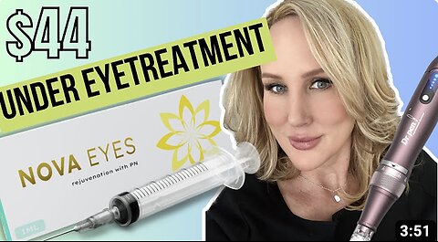 Under eye Treatment // Nova eyes