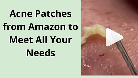 Acne Patches from Amazon to Meet All Your Needs