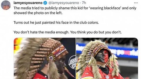 RACE HUSTLE BACKFIRES ON LIBERAL MEDIA CRYING RACISM OVER KID WEARING 'BLACK FACE' TO CHIEFS GAME!