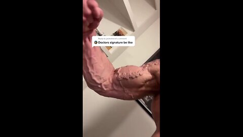 Bodybuilder has mind-blowing shape to his veins