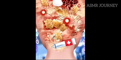 ASMR HEAD INFECTION TREATMENT || ASMR ANIMATION || #asmrsounds #asmrvideo